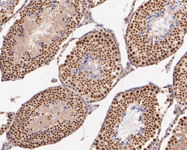 Immunohistochemical analysis of paraffin-embedded mouse testis tissue using anti-XRCC1 antibody. The section was pre-treated using heat mediated antigen retrieval with sodium citrate buffer (pH 6.0) for 20 minutes. The tissues were blocked in 5% BSA for 30 minutes at room temperature, washed with ddH2O and PBS, and then probed with the primary antibody (ET1704-01, 1/200)  for 30 minutes at room temperature. The detection was performed using an HRP conjugated compact polymer system. DAB was used as the chromogen. Tissues were counterstained with hematoxylin and mounted with DPX.
