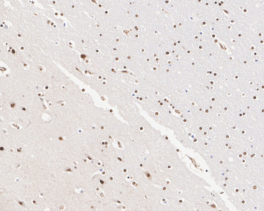 Immunohistochemical analysis of paraffin-embedded mouse spleen tissue with Rabbit anti-53BP1 antibody (ET1704-05) at 1/200 dilution.<br />
<br />
The section was pre-treated using heat mediated antigen retrieval with sodium citrate buffer (pH 6.0) for 2 minutes. The tissues were blocked in 1% BSA for 20 minutes at room temperature, washed with ddH2O and PBS, and then probed with the primary antibody (ET1704-05) at 1/200 dilution for 1 hour at room temperature. The detection was performed using an HRP conjugated compact polymer system. DAB was used as the chromogen. Tissues were counterstained with hematoxylin and mounted with DPX.