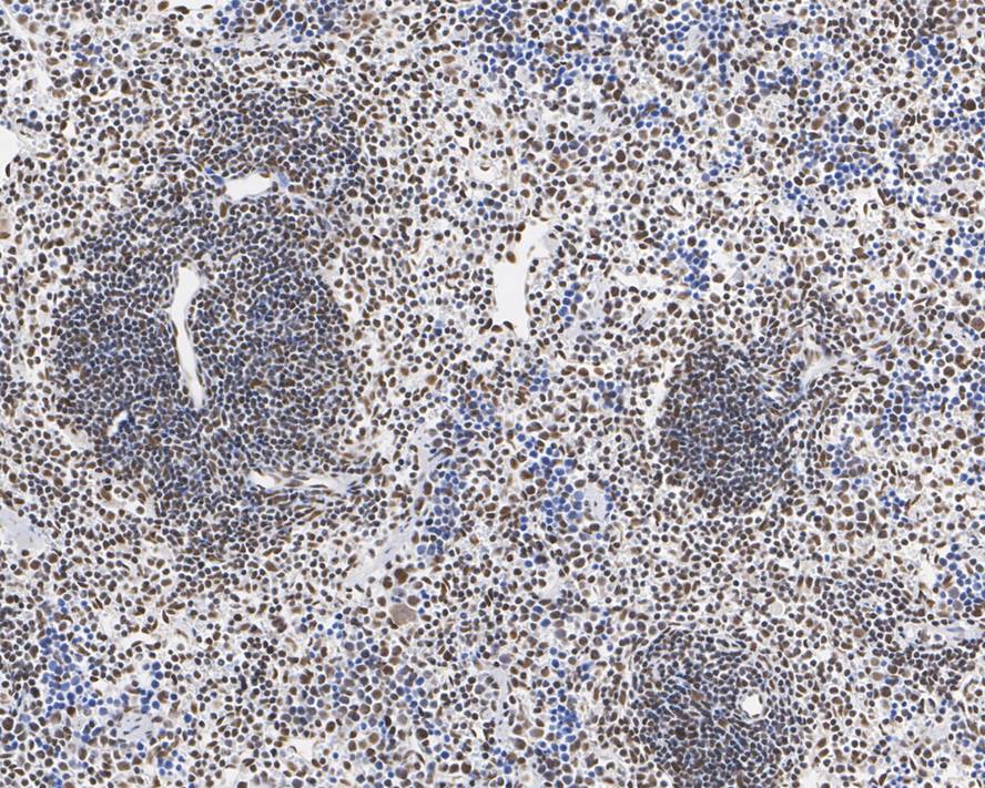 Immunohistochemical analysis of paraffin-embedded mouse testis tissue with Rabbit anti-53BP1 antibody (ET1704-05) at 1/200 dilution.<br />
<br />
The section was pre-treated using heat mediated antigen retrieval with sodium citrate buffer (pH 6.0) for 2 minutes. The tissues were blocked in 1% BSA for 20 minutes at room temperature, washed with ddH2O and PBS, and then probed with the primary antibody (ET1704-05) at 1/200 dilution for 1 hour at room temperature. The detection was performed using an HRP conjugated compact polymer system. DAB was used as the chromogen. Tissues were counterstained with hematoxylin and mounted with DPX.