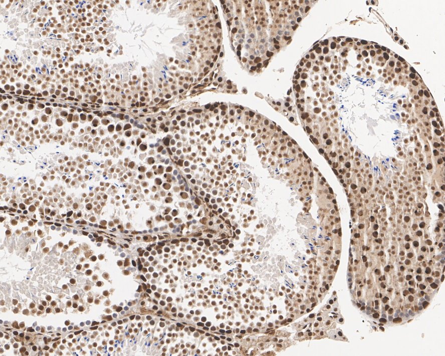 Immunohistochemical analysis of paraffin-embedded rat testis tissue with Rabbit anti-53BP1 antibody (ET1704-05) at 1/200 dilution.<br />
<br />
The section was pre-treated using heat mediated antigen retrieval with sodium citrate buffer (pH 6.0) for 2 minutes. The tissues were blocked in 1% BSA for 20 minutes at room temperature, washed with ddH2O and PBS, and then probed with the primary antibody (ET1704-05) at 1/200 dilution for 1 hour at room temperature. The detection was performed using an HRP conjugated compact polymer system. DAB was used as the chromogen. Tissues were counterstained with hematoxylin and mounted with DPX.
