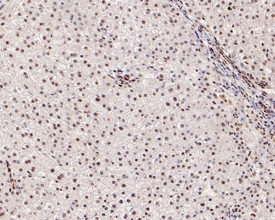 Immunohistochemical analysis of paraffin-embedded mouse spleen tissue using anti-53BP1 antibody. The section was pre-treated using heat mediated antigen retrieval with sodium citrate buffer (pH 6.0) for 20 minutes. The tissues were blocked in 1% BSA for 30 minutes at room temperature, washed with ddH2O and PBS, and then probed with the primary antibody (ET1704-05, 1/50)  for 30 minutes at room temperature. The detection was performed using an HRP conjugated compact polymer system. DAB was used as the chromogen. Tissues were counterstained with hematoxylin and mounted with DPX.