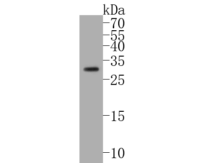 Western blot analysis of BNIP3 on mouse kidney tissue lysates. Proteins were transferred to a PVDF membrane and blocked with 5% BSA in PBS for 1 hour at room temperature. The primary antibody (ET1704-08, 1/500) was used in 5% BSA at room temperature for 2 hours. Goat Anti-Rabbit IgG - HRP Secondary Antibody (HA1001) at 1:5,000 dilution was used for 1 hour at room temperature.