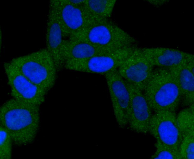 ICC staining of BNIP3 in Hela cells (green). Formalin fixed cells were permeabilized with 0.1% Triton X-100 in TBS for 10 minutes at room temperature and blocked with 1% Blocker BSA for 15 minutes at room temperature. Cells were probed with the primary antibody (ET1704-08, 1/50) for 1 hour at room temperature, washed with PBS. Alexa Fluor®488 Goat anti-Rabbit IgG was used as the secondary antibody at 1/1,000 dilution. The nuclear counter stain is DAPI (blue).