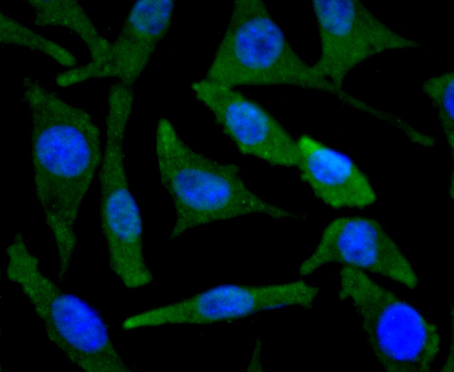 ICC staining of BNIP3 in SH-SY5Y cells (green). Formalin fixed cells were permeabilized with 0.1% Triton X-100 in TBS for 10 minutes at room temperature and blocked with 1% Blocker BSA for 15 minutes at room temperature. Cells were probed with the primary antibody (ET1704-08, 1/50) for 1 hour at room temperature, washed with PBS. Alexa Fluor®488 Goat anti-Rabbit IgG was used as the secondary antibody at 1/1,000 dilution. The nuclear counter stain is DAPI (blue).