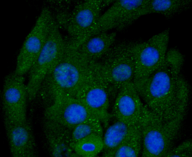 ICC staining of BNIP3 in NIH/3T3 cells (green). Formalin fixed cells were permeabilized with 0.1% Triton X-100 in TBS for 10 minutes at room temperature and blocked with 1% Blocker BSA for 15 minutes at room temperature. Cells were probed with the primary antibody (ET1704-08, 1/50) for 1 hour at room temperature, washed with PBS. Alexa Fluor®488 Goat anti-Rabbit IgG was used as the secondary antibody at 1/1,000 dilution. The nuclear counter stain is DAPI (blue).
