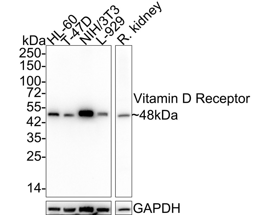 Western blot analysis of Vitamin D Receptor on different lysates. Proteins were transferred to a PVDF membrane and blocked with 5% BSA in PBS for 1 hour at room temperature. The primary antibody (ET1704-09, 1/500) was used in 5% BSA at room temperature for 2 hours. Goat Anti-Rabbit IgG - HRP Secondary Antibody (HA1001) at 1:200,000 dilution was used for 1 hour at room temperature.<br />
Positive control: <br />
Lane 1: MCF-7 cell lysate<br />
Lane 2: U937 cell lysate