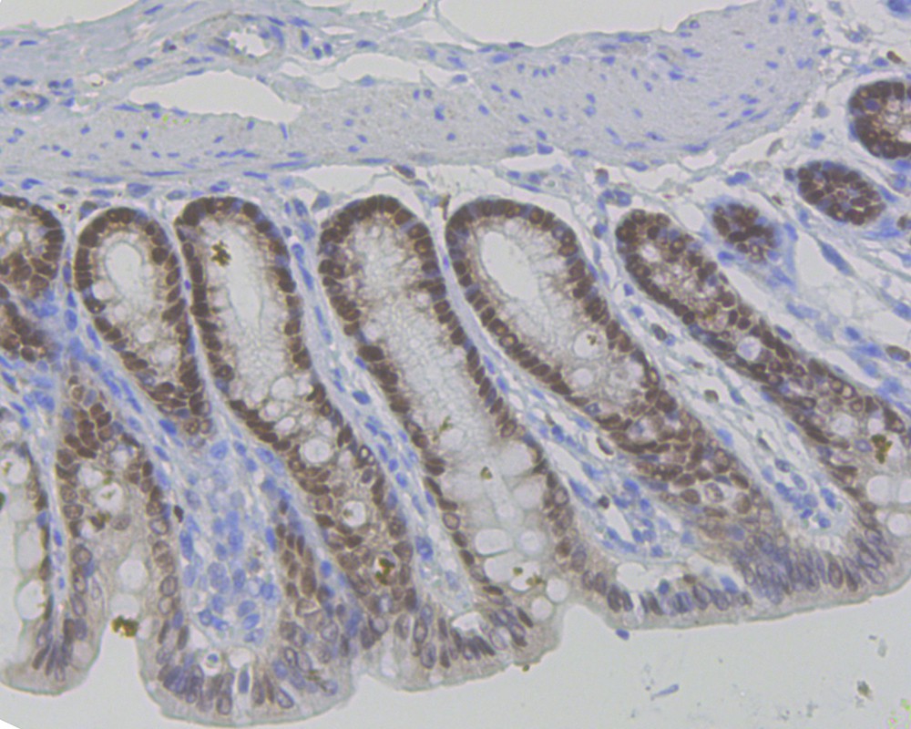 Immunohistochemical analysis of paraffin-embedded rat large intestine tissue using anti-Vitamin D Receptor antibody. The section was pre-treated using heat mediated antigen retrieval with sodium citrate buffer (pH 6.0) for 20 minutes. The tissues were blocked in 5% BSA for 30 minutes at room temperature, washed with ddH2O and PBS, and then probed with the primary antibody (ET1704-09, 1/50)  for 30 minutes at room temperature. The detection was performed using an HRP conjugated compact polymer system. DAB was used as the chromogen. Tissues were counterstained with hematoxylin and mounted with DPX.