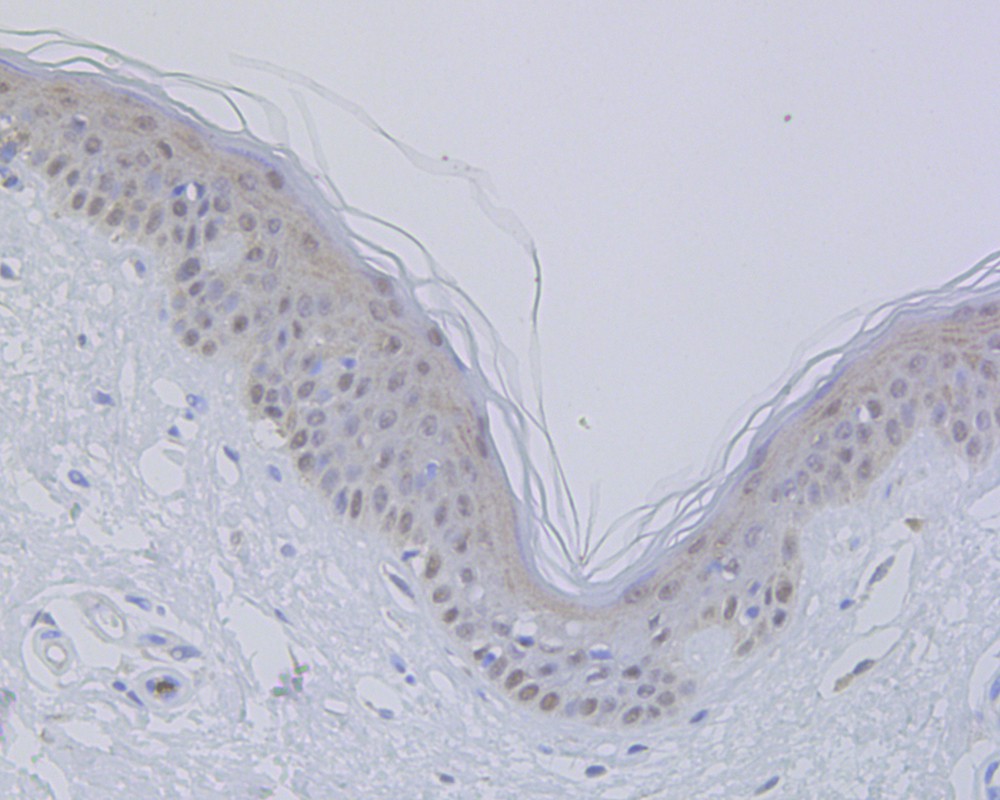 Immunohistochemical analysis of paraffin-embedded human skin tissue using anti-Vitamin D Receptor antibody. The section was pre-treated using heat mediated antigen retrieval with sodium citrate buffer (pH 6.0) for 20 minutes. The tissues were blocked in 5% BSA for 30 minutes at room temperature, washed with ddH2O and PBS, and then probed with the primary antibody (ET1704-09, 1/50)  for 30 minutes at room temperature. The detection was performed using an HRP conjugated compact polymer system. DAB was used as the chromogen. Tissues were counterstained with hematoxylin and mounted with DPX.