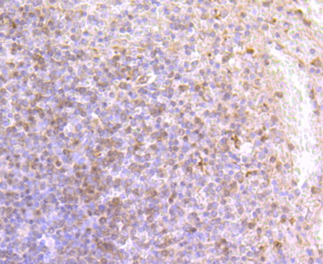 Immunohistochemical analysis of paraffin-embedded human spleen tissue using anti-DCAMKL1 antibody. The section was pre-treated using heat mediated antigen retrieval with Tris-EDTA buffer (pH 9.0) for 20 minutes.The tissues were blocked in 5% BSA for 30 minutes at room temperature, washed with ddH2O and PBS, and then probed with the primary antibody (ET1704-10, 1/50) for 30 minutes at room temperature. The detection was performed using an HRP conjugated compact polymer system. DAB was used as the chromogen. Tissues were counterstained with hematoxylin and mounted with DPX.