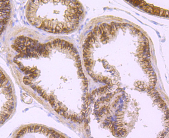 Immunohistochemical analysis of paraffin-embedded mouse prostate tissue using anti-DCAMKL1 antibody. The section was pre-treated using heat mediated antigen retrieval with Tris-EDTA buffer (pH 9.0) for 20 minutes.The tissues were blocked in 5% BSA for 30 minutes at room temperature, washed with ddH2O and PBS, and then probed with the primary antibody (ET1704-10, 1/50) for 30 minutes at room temperature. The detection was performed using an HRP conjugated compact polymer system. DAB was used as the chromogen. Tissues were counterstained with hematoxylin and mounted with DPX.