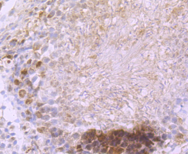 Immunohistochemical analysis of paraffin-embedded rat testis tissue using anti-DCAMKL1 antibody. The section was pre-treated using heat mediated antigen retrieval with Tris-EDTA buffer (pH 9.0) for 20 minutes.The tissues were blocked in 5% BSA for 30 minutes at room temperature, washed with ddH2O and PBS, and then probed with the primary antibody (ET1704-10, 1/50) for 30 minutes at room temperature. The detection was performed using an HRP conjugated compact polymer system. DAB was used as the chromogen. Tissues were counterstained with hematoxylin and mounted with DPX.