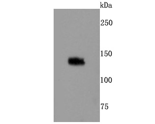 Western blot analysis of TLR7 on Daudi cell lysates. Proteins were transferred to a PVDF membrane and blocked with 5% BSA in PBS for 1 hour at room temperature. The primary antibody (ET1704-11, 1/500) was used in 5% BSA at room temperature for 2 hours. Goat Anti-Rabbit IgG - HRP Secondary Antibody (HA1001) at 1:200,000 dilution was used for 1 hour at room temperature.