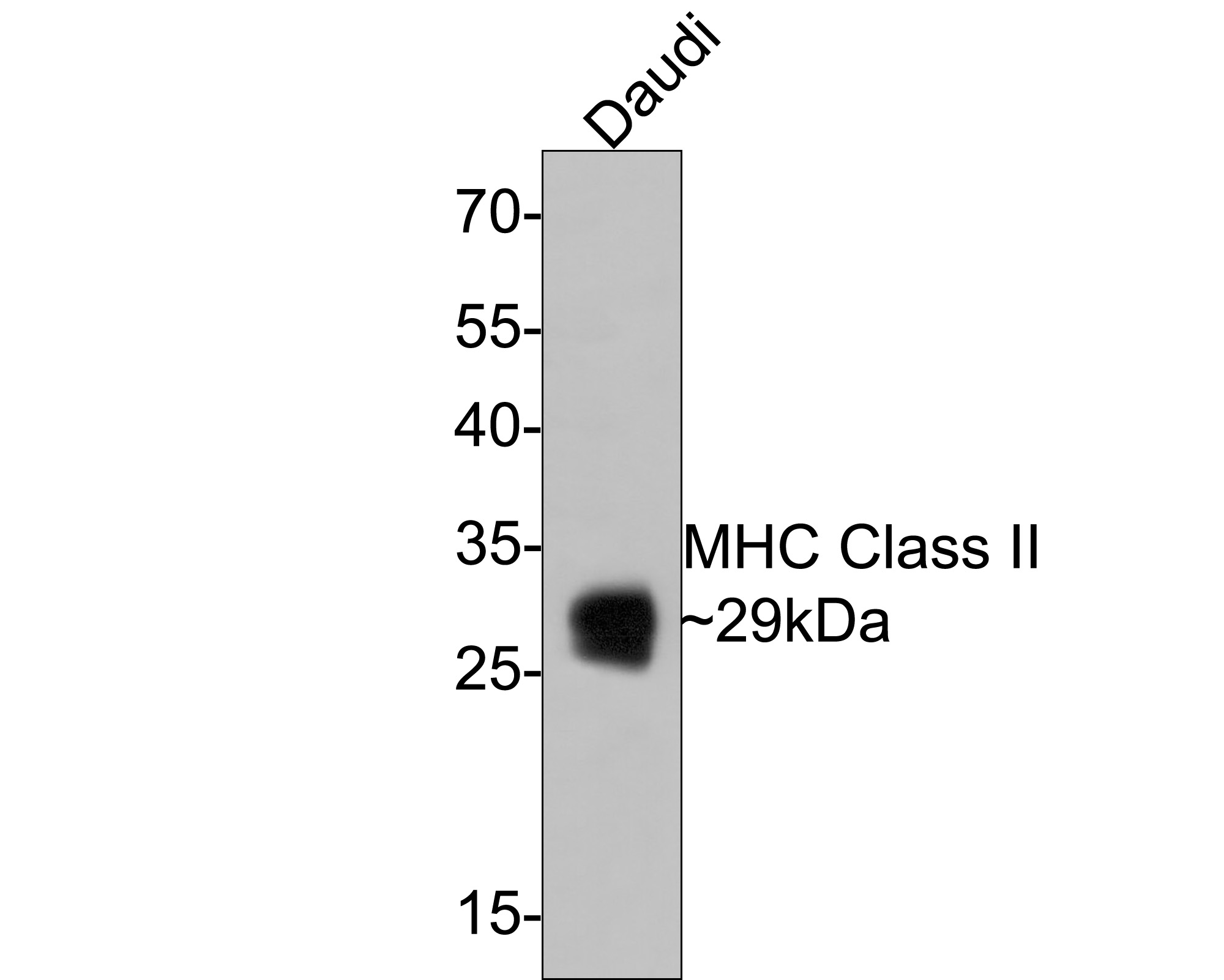 Western blot analysis of MHC Class II on Daudi cell lysates with Rabbit anti-MHC Class II antibody (ET1704-13) at 1/500 dilution.<br />
<br />
Lysates/proteins at 10 µg/Lane.<br />
<br />
Predicted band size: 29 kDa<br />
Observed band size: 29 kDa<br />
<br />
Exposure time: 1 minute;<br />
<br />
12% SDS-PAGE gel.<br />
<br />
Proteins were transferred to a PVDF membrane and blocked with 5% NFDM/TBST for 1 hour at room temperature. The primary antibody (ET1704-13) at 1/500 dilution was used in 5% NFDM/TBST at room temperature for 2 hours. Goat Anti-Rabbit IgG - HRP Secondary Antibody (HA1001) at 1:300,000 dilution was used for 1 hour at room temperature.