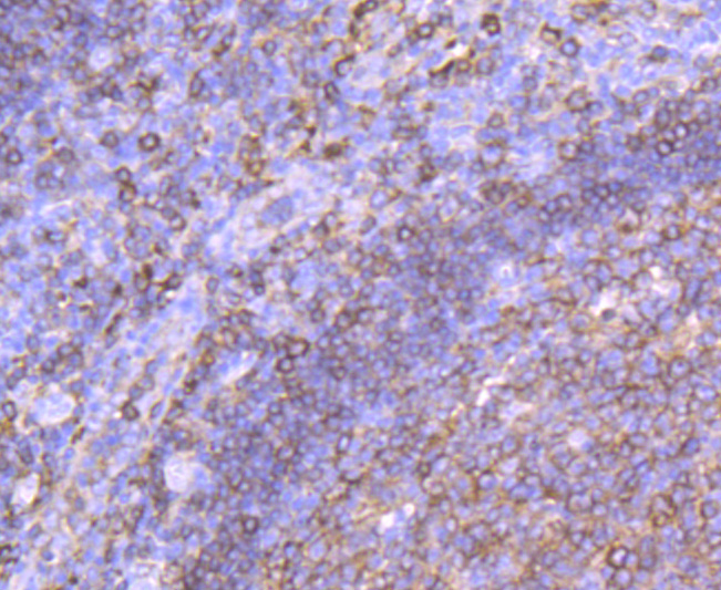 Immunohistochemical analysis of paraffin-embedded human tonsil tissue using anti-MHC Class II antibody. The section was pre-treated using heat mediated antigen retrieval with Tris-EDTA buffer (pH 9.0) for 20 minutes.The tissues were blocked in 5% BSA for 30 minutes at room temperature, washed with ddH2O and PBS, and then probed with the primary antibody (ET1704-13, 1/50) for 30 minutes at room temperature. The detection was performed using an HRP conjugated compact polymer system. DAB was used as the chromogen. Tissues were counterstained with hematoxylin and mounted with DPX.