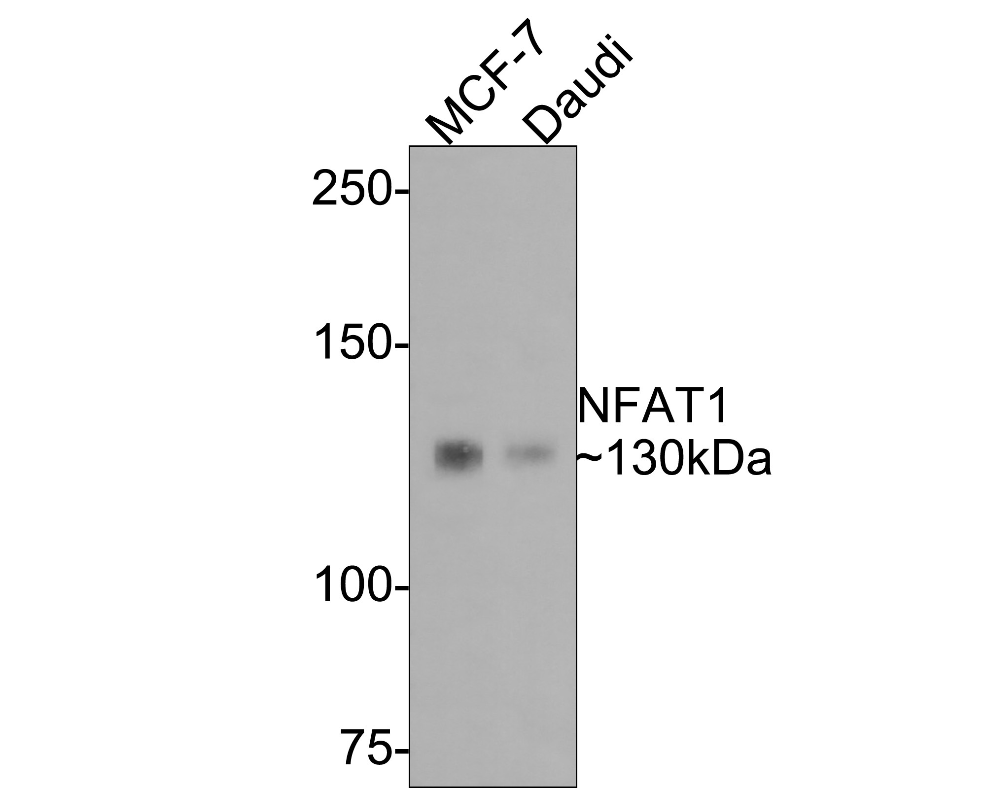 Western blot analysis of NFAT1 on different lysates with Rabbit anti-NFAT1 antibody (ET1704-14) at 1/500 dilution.<br />
<br />
Lane 1: MCF-7 cell lysate<br />
Lane 2: Daudi cell lysate<br />
<br />
Lysates/proteins at 10 µg/Lane.<br />
<br />
Predicted band size: 100 kDa<br />
Observed band size: 130 kDa<br />
<br />
Exposure time: 2 minutes;<br />
<br />
6% SDS-PAGE gel.<br />
<br />
Proteins were transferred to a PVDF membrane and blocked with 5% NFDM/TBST for 1 hour at room temperature. The primary antibody (ET1704-14) at 1/500 dilution was used in 5% NFDM/TBST at room temperature for 2 hours. Goat Anti-Rabbit IgG - HRP Secondary Antibody (HA1001) at 1:300,000 dilution was used for 1 hour at room temperature.