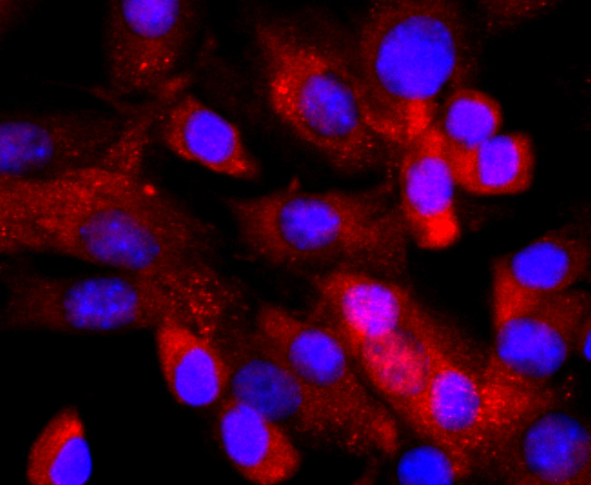 ICC staining of NFAT1 in SHG-44 cells (red). Formalin fixed cells were permeabilized with 0.1% Triton X-100 in TBS for 10 minutes at room temperature and blocked with 10% negative goat serum for 15 minutes at room temperature. Cells were probed with the primary antibody (ET1704-14, 1/50) for 1 hour at room temperature, washed with PBS. Alexa Fluor®594 conjugate-Goat anti-Rabbit IgG was used as the secondary antibody at 1/1,000 dilution. The nuclear counter stain is DAPI (blue).