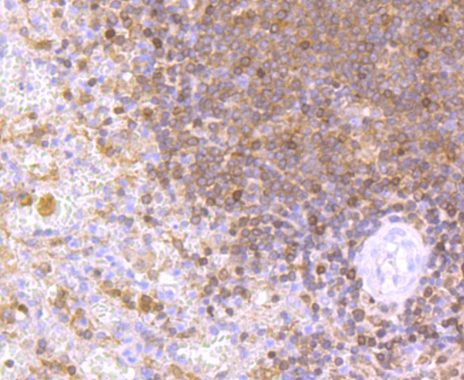 Immunohistochemical analysis of paraffin-embedded human spleen tissue using anti-NFAT1 antibody. The section was pre-treated using heat mediated antigen retrieval with Tris-EDTA buffer (pH 9.0) for 20 minutes.The tissues were blocked in 1% BSA for 30 minutes at room temperature, washed with ddH2O and PBS, and then probed with the primary antibody (ET1704-14, 1/50) for 30 minutes at room temperature. The detection was performed using an HRP conjugated compact polymer system. DAB was used as the chromogen. Tissues were counterstained with hematoxylin and mounted with DPX.