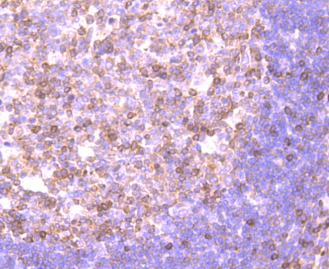 Immunohistochemical analysis of paraffin-embedded human tonsil tissue using anti-NFAT1 antibody. The section was pre-treated using heat mediated antigen retrieval with Tris-EDTA buffer (pH 9.0) for 20 minutes.The tissues were blocked in 1% BSA for 30 minutes at room temperature, washed with ddH2O and PBS, and then probed with the primary antibody (ET1704-14, 1/50) for 30 minutes at room temperature. The detection was performed using an HRP conjugated compact polymer system. DAB was used as the chromogen. Tissues were counterstained with hematoxylin and mounted with DPX.