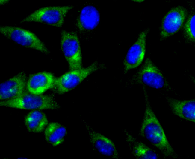 ICC staining of PKA 2 beta (regulatory subunit) in SH-SY5Y cells (green). Formalin fixed cells were permeabilized with 0.1% Triton X-100 in TBS for 10 minutes at room temperature and blocked with 10% negative goat serum for 15 minutes at room temperature. Cells were probed with the primary antibody (ET1704-15, 1/50) for 1 hour at room temperature, washed with PBS. Alexa Fluor®488 conjugate-Goat anti-Rabbit IgG was used as the secondary antibody at 1/1,000 dilution. The nuclear counter stain is DAPI (blue).