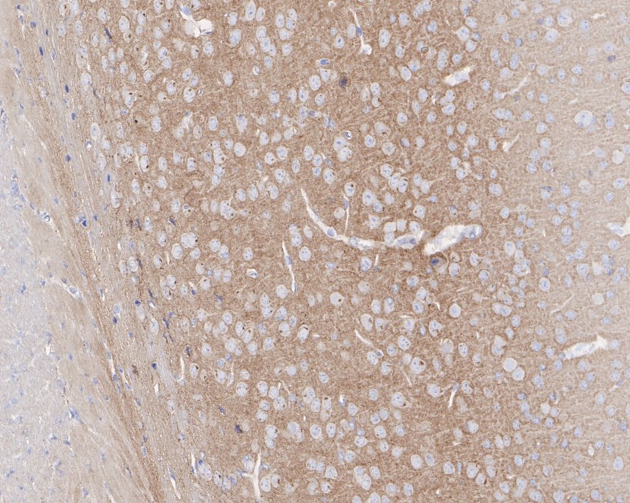 Immunohistochemical analysis of paraffin-embedded mouse brain tissue using anti-PKA 2 beta (regulatory subunit) antibody. The section was pre-treated using heat mediated antigen retrieval with Tris-EDTA buffer (pH 9.0) for 20 minutes.The tissues were blocked in 1% BSA for 30 minutes at room temperature, washed with ddH2O and PBS, and then probed with the primary antibody (ET1704-15, 1/50) for 30 minutes at room temperature. The detection was performed using an HRP conjugated compact polymer system. DAB was used as the chromogen. Tissues were counterstained with hematoxylin and mounted with DPX.