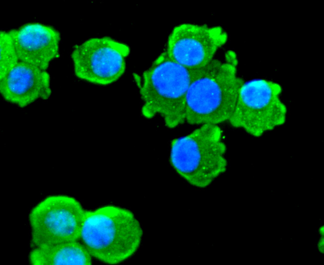 ICC staining of Choline Acetyltransferase in SH-SY5Y cells (green). Formalin fixed cells were permeabilized with 0.1% Triton X-100 in TBS for 10 minutes at room temperature and blocked with 1% Blocker BSA for 15 minutes at room temperature. Cells were probed with the primary antibody (ET1704-16, 1/50) for 1 hour at room temperature, washed with PBS. Alexa Fluor®488 Goat anti-Rabbit IgG was used as the secondary antibody at 1/1,000 dilution. The nuclear counter stain is DAPI (blue).
