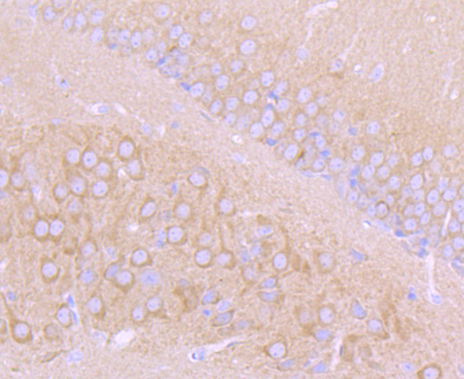 Immunohistochemical analysis of paraffin-embedded rat stomach tissue using anti-Choline Acetyltransferase antibody. The section was pre-treated using heat mediated antigen retrieval with Tris-EDTA buffer (pH 8.0-8.4) for 20 minutes.The tissues were blocked in 5% BSA for 30 minutes at room temperature, washed with ddH2O and PBS, and then probed with the primary antibody (ET1704-16, 1/50) for 30 minutes at room temperature. The detection was performed using an HRP conjugated compact polymer system. DAB was used as the chromogen. Tissues were counterstained with hematoxylin and mounted with DPX.
