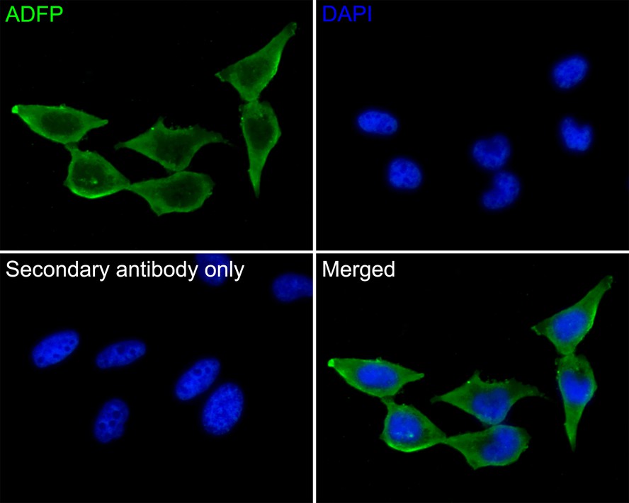 Immunocytochemistry analysis of Hela cells labeling ADFP with Rabbit anti-ADFP antibody (ET1704-17) at 1/50 dilution.<br />
<br />
Cells were fixed in 4% paraformaldehyde for 10 minutes at 37 ℃, permeabilized with 0.05% Triton X-100 in PBS for 20 minutes, and then blocked with 2% negative goat serum for 30 minutes at room temperature. Cells were then incubated with Rabbit anti-ADFP antibody (ET1704-17) at 1/50 dilution in 2% negative goat serum overnight at 4 ℃. Goat Anti-Rabbit IgG H&L (iFluor™ 488, HA1121) was used as the secondary antibody at 1/1,000 dilution. PBS instead of the primary antibody was used as the secondary antibody only control. Nuclear DNA was labelled in blue with DAPI.