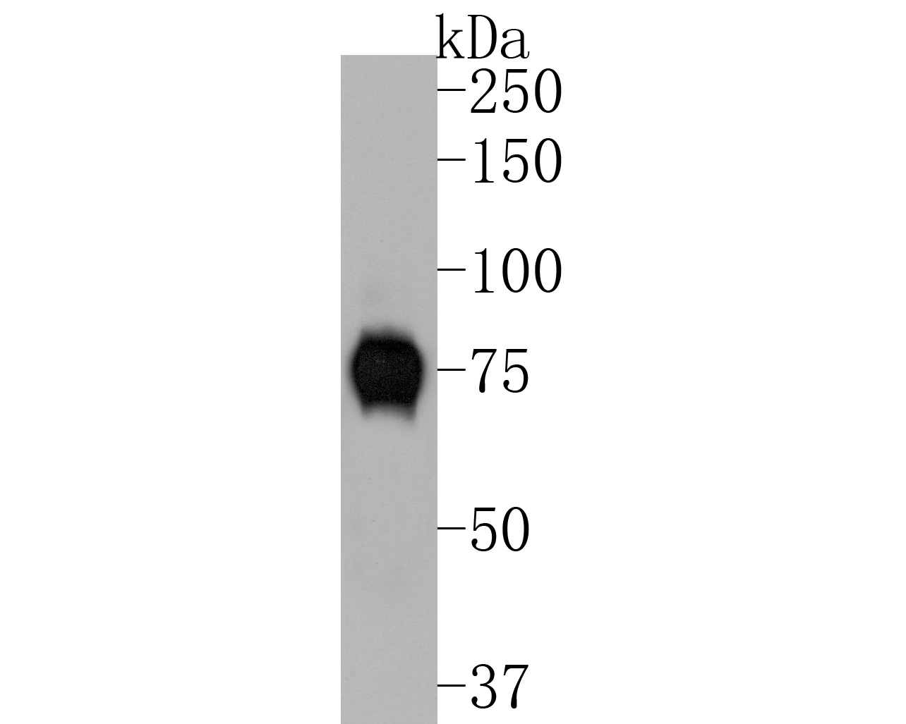 Western blot analysis of Tyrosinase on B16F1 cell lysates. Proteins were transferred to a PVDF membrane and blocked with 5% BSA in PBS for 1 hour at room temperature. The primary antibody (ET1704-18, 1/500) was used in 5% BSA at room temperature for 2 hours. Goat Anti-Rabbit IgG - HRP Secondary Antibody (HA1001) at 1:200,000 dilution was used for 1 hour at room temperature.