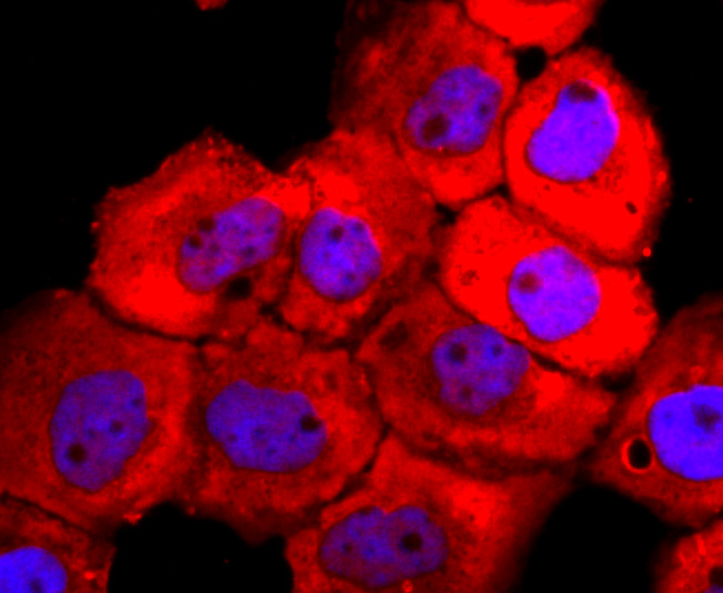 ICC staining of Tyrosinase in A431 cells (red). Formalin fixed cells were permeabilized with 0.1% Triton X-100 in TBS for 10 minutes at room temperature and blocked with 1% Blocker BSA for 15 minutes at room temperature. Cells were probed with the primary antibody (ET1704-18, 1/50) for 1 hour at room temperature, washed with PBS. Alexa Fluor®594 Goat anti-Rabbit IgG was used as the secondary antibody at 1/1,000 dilution. The nuclear counter stain is DAPI (blue).