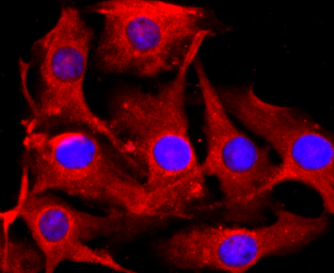 ICC staining of Tyrosinase in B16F1 cells (red). Formalin fixed cells were permeabilized with 0.1% Triton X-100 in TBS for 10 minutes at room temperature and blocked with 1% Blocker BSA for 15 minutes at room temperature. Cells were probed with the primary antibody (ET1704-18, 1/50) for 1 hour at room temperature, washed with PBS. Alexa Fluor®594 Goat anti-Rabbit IgG was used as the secondary antibody at 1/1,000 dilution. The nuclear counter stain is DAPI (blue).