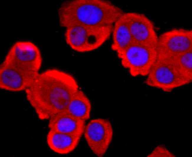 ICC staining of Tyrosinase in MCF-7 cells (red). Formalin fixed cells were permeabilized with 0.1% Triton X-100 in TBS for 10 minutes at room temperature and blocked with 1% Blocker BSA for 15 minutes at room temperature. Cells were probed with the primary antibody (ET1704-18, 1/50) for 1 hour at room temperature, washed with PBS. Alexa Fluor®594 Goat anti-Rabbit IgG was used as the secondary antibody at 1/1,000 dilution. The nuclear counter stain is DAPI (blue).