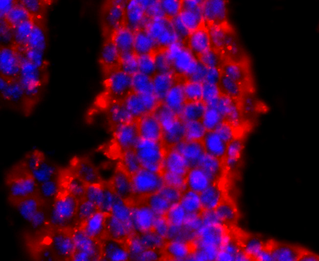 ICC staining of PRMT1 in D3 cells (red). Formalin fixed cells were permeabilized with 0.1% Triton X-100 in TBS for 10 minutes at room temperature and blocked with 1% Blocker BSA for 15 minutes at room temperature. Cells were probed with the primary antibody (ET1704-19, 1/50) for 1 hour at room temperature, washed with PBS. Alexa Fluor®594 Goat anti-Rabbit IgG was used as the secondary antibody at 1/1,000 dilution. The nuclear counter stain is DAPI (blue).
