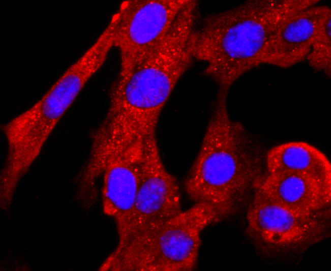 ICC staining of PRMT1 in NIH/3T3 cells (red). Formalin fixed cells were permeabilized with 0.1% Triton X-100 in TBS for 10 minutes at room temperature and blocked with 1% Blocker BSA for 15 minutes at room temperature. Cells were probed with the primary antibody (ET1704-19, 1/50) for 1 hour at room temperature, washed with PBS. Alexa Fluor®594 Goat anti-Rabbit IgG was used as the secondary antibody at 1/1,000 dilution. The nuclear counter stain is DAPI (blue).