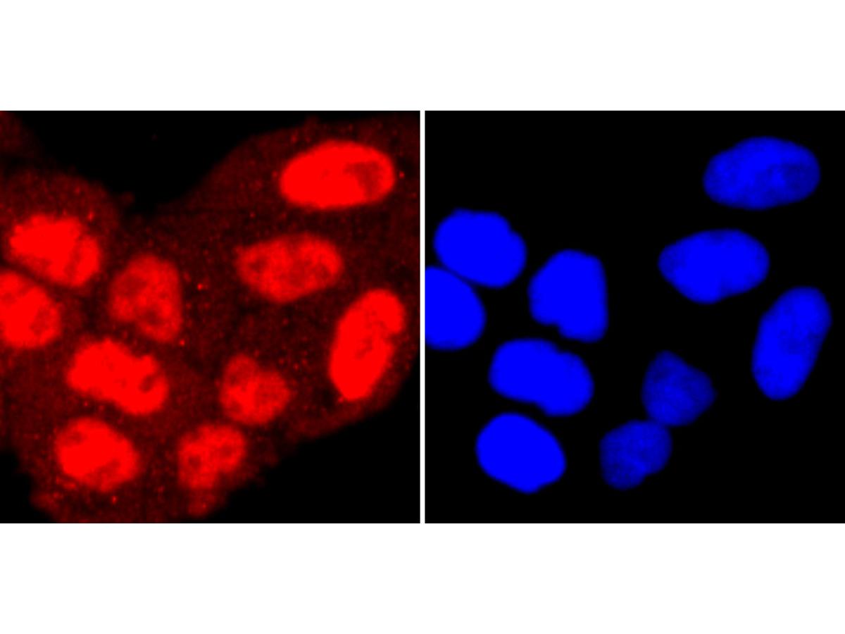 ICC staining of PRMT1 in Hela cells (red). Formalin fixed cells were permeabilized with 0.1% Triton X-100 in TBS for 10 minutes at room temperature and blocked with 1% Blocker BSA for 15 minutes at room temperature. Cells were probed with the primary antibody (ET1704-19, 1/50) for 1 hour at room temperature, washed with PBS. Alexa Fluor®594 Goat anti-Rabbit IgG was used as the secondary antibody at 1/1,000 dilution. The nuclear counter stain is DAPI (blue).