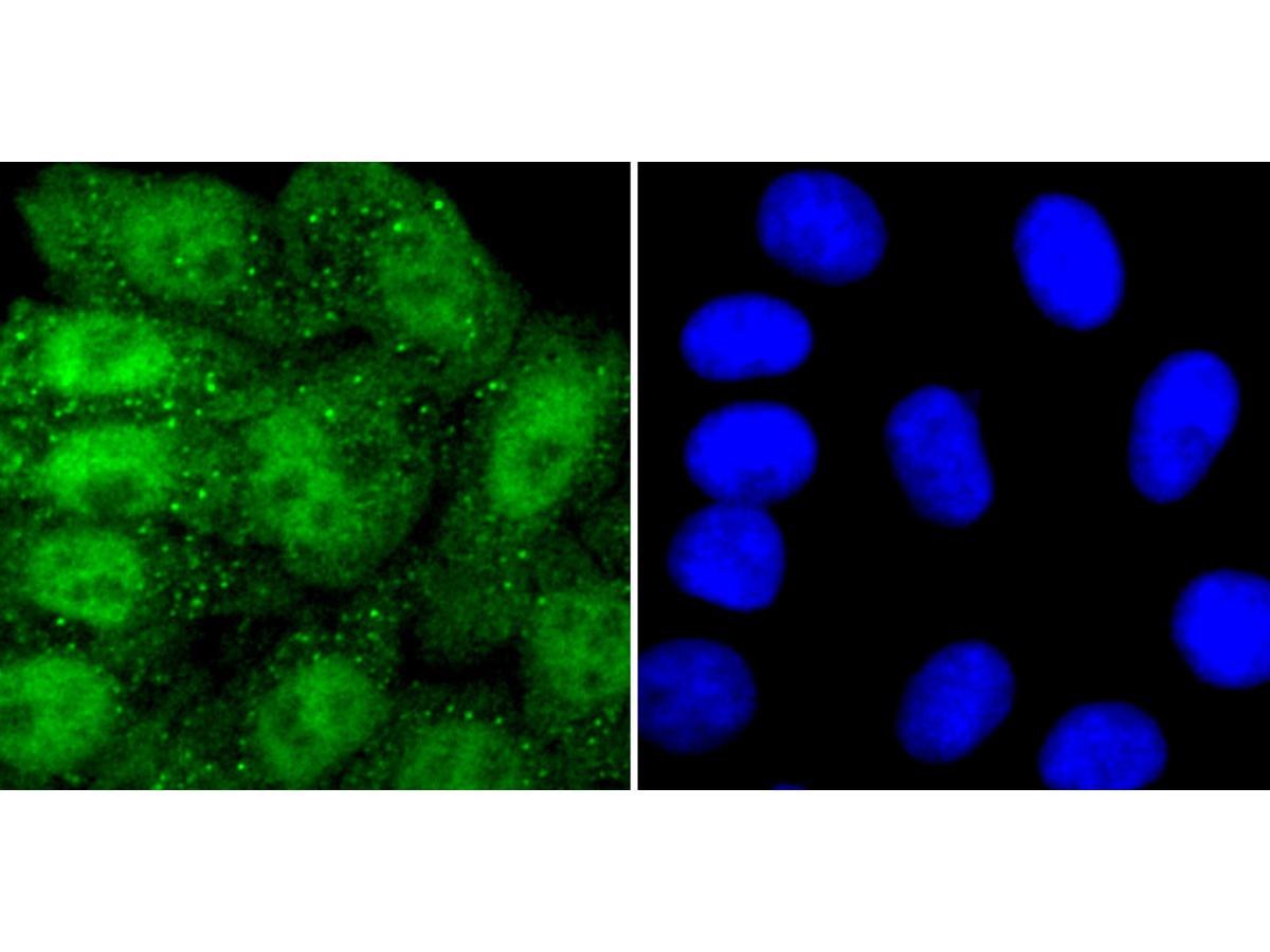 ICC staining of PRMT1 in HepG2 cells (green). Formalin fixed cells were permeabilized with 0.1% Triton X-100 in TBS for 10 minutes at room temperature and blocked with 1% Blocker BSA for 15 minutes at room temperature. Cells were probed with the primary antibody (ET1704-19, 1/50) for 1 hour at room temperature, washed with PBS. Alexa Fluor®488 Goat anti-Rabbit IgG was used as the secondary antibody at 1/1,000 dilution. The nuclear counter stain is DAPI (blue).