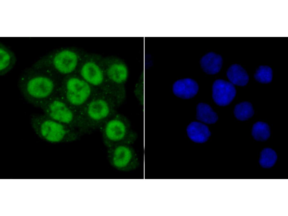 ICC staining of PRMT1 in SW480 cells (green). Formalin fixed cells were permeabilized with 0.1% Triton X-100 in TBS for 10 minutes at room temperature and blocked with 1% Blocker BSA for 15 minutes at room temperature. Cells were probed with the primary antibody (ET1704-19, 1/50) for 1 hour at room temperature, washed with PBS. Alexa Fluor®488 Goat anti-Rabbit IgG was used as the secondary antibody at 1/1,000 dilution. The nuclear counter stain is DAPI (blue).