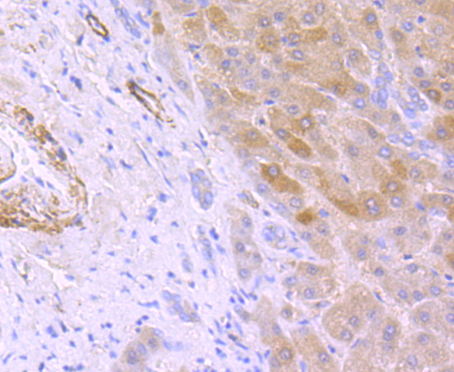Immunohistochemical analysis of paraffin-embedded human liver tissue using anti- Hepcidin antibody. Counter stained with hematoxylin.