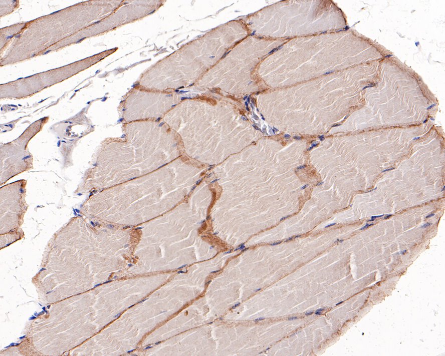 Immunohistochemical analysis of paraffin-embedded human striated muscle tissue with Rabbit anti-gamma Sarcoglycan antibody (ET1704-24) at 1/200 dilution.<br />
<br />
The section was pre-treated using heat mediated antigen retrieval with Tris-EDTA buffer (pH 9.0) for 20 minutes. The tissues were blocked in 1% BSA for 20 minutes at room temperature, washed with ddH2O and PBS, and then probed with the primary antibody (ET1704-24) at 1/200 dilution for 1 hour at room temperature. The detection was performed using an HRP conjugated compact polymer system. DAB was used as the chromogen. Tissues were counterstained with hematoxylin and mounted with DPX.