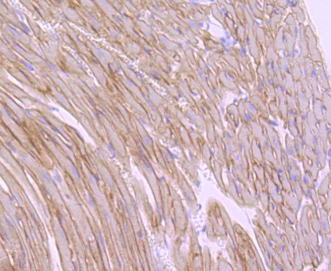 Immunohistochemical analysis of paraffin-embedded mouse heart tissue using anti-alpha sarcoglycan antibody. The section was pre-treated using heat mediated antigen retrieval with Tris-EDTA buffer (pH 8.0-8.4) for 20 minutes.The tissues were blocked in 5% BSA for 30 minutes at room temperature, washed with ddH2O and PBS, and then probed with the primary antibody (ET1704-25, 1/50) for 30 minutes at room temperature. The detection was performed using an HRP conjugated compact polymer system. DAB was used as the chromogen. Tissues were counterstained with hematoxylin and mounted with DPX.