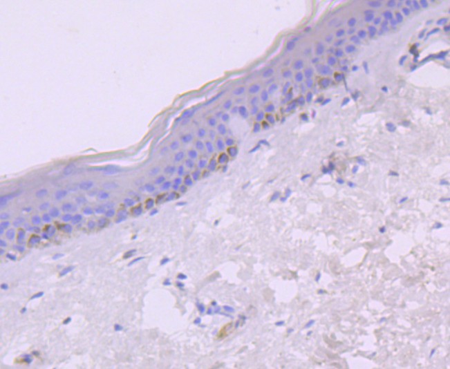Immunohistochemical analysis of paraffin-embedded human skin tissue using anti-IP10 antibody. The section was pre-treated using heat mediated antigen retrieval with Tris-EDTA buffer (pH 9.0) for 20 minutes.The tissues were blocked in 1% BSA for 30 minutes at room temperature, washed with ddH2O and PBS, and then probed with the primary antibody (ET1704-27, 1/50) for 30 minutes at room temperature. The detection was performed using an HRP conjugated compact polymer system. DAB was used as the chromogen. Tissues were counterstained with hematoxylin and mounted with DPX.