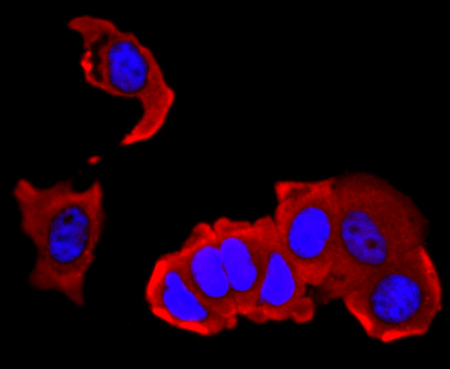 ICC staining of IL4 in MCF-7 cells (red). Formalin fixed cells were permeabilized with 0.1% Triton X-100 in TBS for 10 minutes at room temperature and blocked with 10% negative goat serum for 15 minutes at room temperature. Cells were probed with the primary antibody (ET1704-28, 1/50) for 1 hour at room temperature, washed with PBS. Alexa Fluor®594 conjugate-Goat anti-Rabbit IgG was used as the secondary antibody at 1/1,000 dilution. The nuclear counter stain is DAPI (blue).