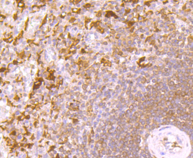 Immunohistochemical analysis of paraffin-embedded human spleen tissue using anti-IL4 antibody. The section was pre-treated using heat mediated antigen retrieval with Tris-EDTA buffer (pH 9.0) for 20 minutes.The tissues were blocked in 1% BSA for 30 minutes at room temperature, washed with ddH2O and PBS, and then probed with the primary antibody (ET1704-28, 1/50) for 30 minutes at room temperature. The detection was performed using an HRP conjugated compact polymer system. DAB was used as the chromogen. Tissues were counterstained with hematoxylin and mounted with DPX.