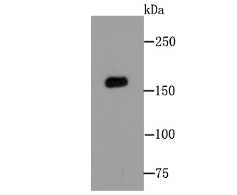 Western blot analysis of MSH6 on Hela cell lysates using anti-MSH6 at 1/500 dilution.