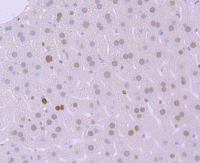Immunohistochemical analysis of paraffin-embedded mouse liver tissue using anti-MSH6 antibody. Counter stained with hematoxylin.