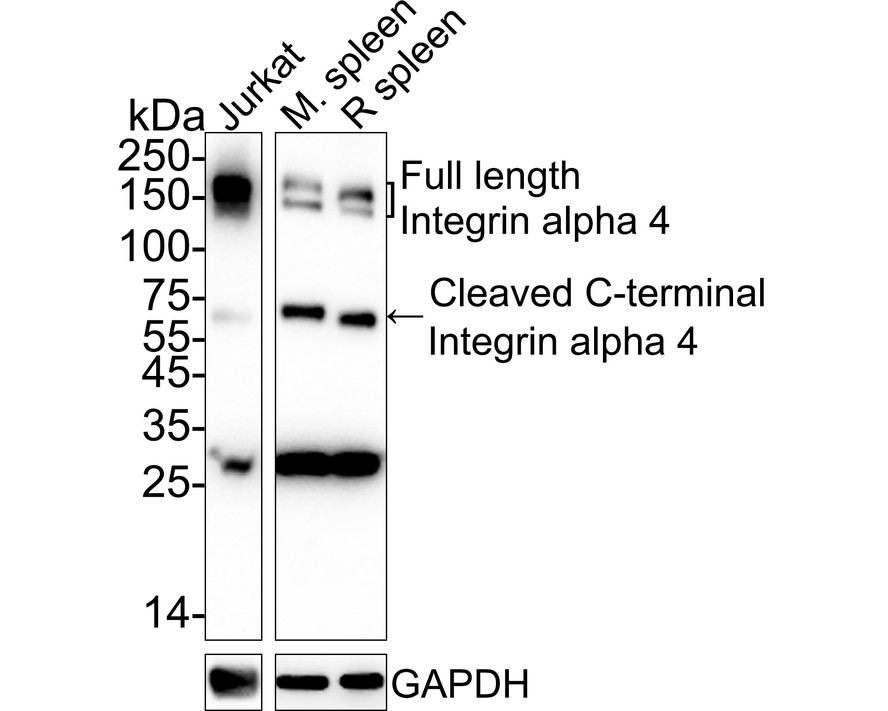 Immunohistochemical analysis of paraffin-embedded human tonsil tissue using anti-Integrin alpha 4 antibody. The section was pre-treated using heat mediated antigen retrieval with Tris-EDTA buffer (pH 9.0) for 20 minutes.The tissues were blocked in 1% BSA for 30 minutes at room temperature, washed with ddH2O and PBS, and then probed with the primary antibody (ET1704-31, 1/50) for 30 minutes at room temperature. The detection was performed using an HRP conjugated compact polymer system. DAB was used as the chromogen. Tissues were counterstained with hematoxylin and mounted with DPX.