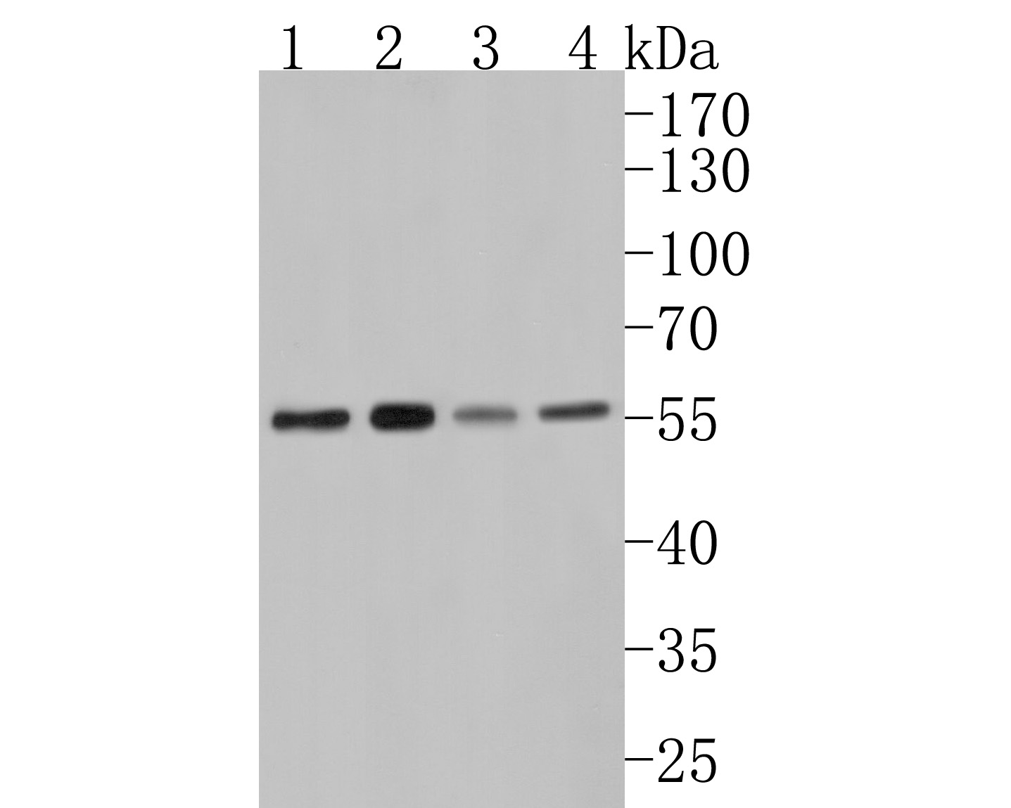 Western blot analysis of GATA4 on different lysates. Proteins were transferred to a PVDF membrane and blocked with 5% BSA in PBS for 1 hour at room temperature. The primary antibody (ET1704-32, 1/500) was used in 5% BSA at room temperature for 2 hours. Goat Anti-Rabbit IgG - HRP Secondary Antibody (HA1001) at 1:200,000 dilution was used for 1 hour at room temperature.<br />
Positive control: <br />
Lane 2: Hela cell lysate<br />
Lane 2: 293 cell lysate<br />
Lane 1: Rat liver tissue lysate<br />
Lane 2: PC-3 cell lysate