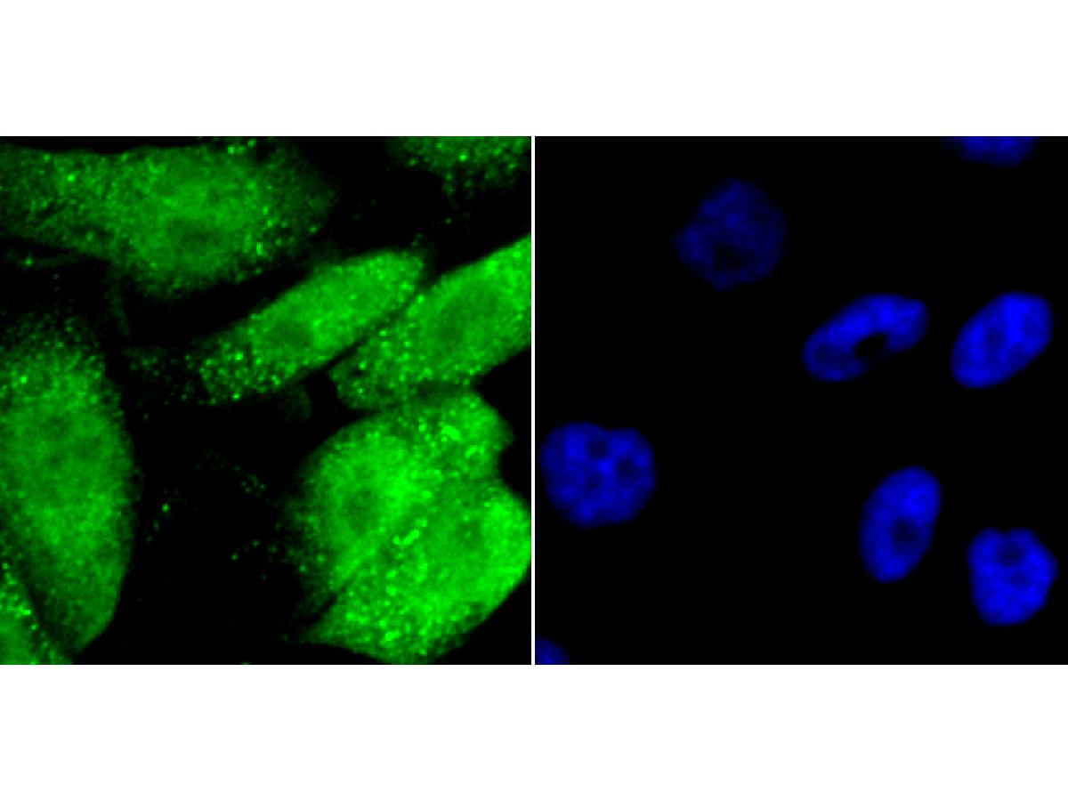 ICC staining of GATA4 in PC-3M cells (green). Formalin fixed cells were permeabilized with 0.1% Triton X-100 in TBS for 10 minutes at room temperature and blocked with 10% negative goat serum for 15 minutes at room temperature. Cells were probed with the primary antibody (ET1704-32, 1/50) for 1 hour at room temperature, washed with PBS. Alexa Fluor®488 conjugate-Goat anti-Rabbit IgG was used as the secondary antibody at 1/1,000 dilution. The nuclear counter stain is DAPI (blue).