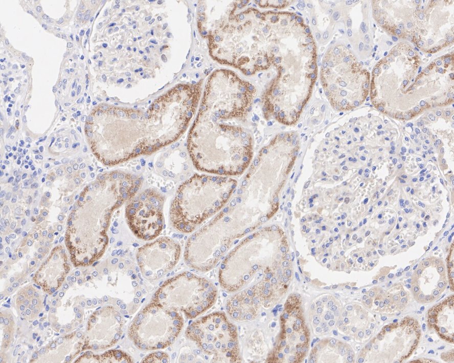 Immunohistochemical analysis of paraffin-embedded human kidney tissue with Rabbit anti-EGF antibody (ET1704-33) at 1/50 dilution.<br />
<br />
The section was pre-treated using heat mediated antigen retrieval with Tris-EDTA buffer (pH 9.0) for 20 minutes. The tissues were blocked in 1% BSA for 20 minutes at room temperature, washed with ddH2O and PBS, and then probed with the primary antibody (ET1704-33) at 1/50 dilution for 1 hour at room temperature. The detection was performed using an HRP conjugated compact polymer system. DAB was used as the chromogen. Tissues were counterstained with hematoxylin and mounted with DPX.