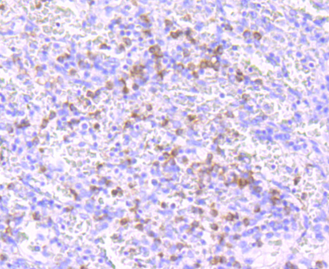 Immunohistochemical analysis of paraffin-embedded human spleen tissue using anti-Noxa antibody. The section was pre-treated using heat mediated antigen retrieval with Tris-EDTA buffer (pH 9.0) for 20 minutes.The tissues were blocked in 1% BSA for 30 minutes at room temperature, washed with ddH2O and PBS, and then probed with the primary antibody (ET1704-35, 1/50) for 30 minutes at room temperature. The detection was performed using an HRP conjugated compact polymer system. DAB was used as the chromogen. Tissues were counterstained with hematoxylin and mounted with DPX.