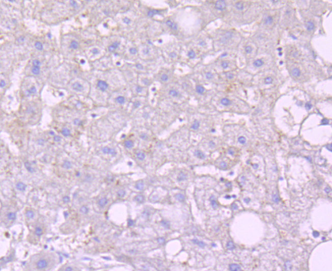Immunohistochemical analysis of paraffin-embedded human liver tissue using anti-Noxa antibody. The section was pre-treated using heat mediated antigen retrieval with Tris-EDTA buffer (pH 9.0) for 20 minutes.The tissues were blocked in 1% BSA for 30 minutes at room temperature, washed with ddH2O and PBS, and then probed with the primary antibody (ET1704-35, 1/50) for 30 minutes at room temperature. The detection was performed using an HRP conjugated compact polymer system. DAB was used as the chromogen. Tissues were counterstained with hematoxylin and mounted with DPX.